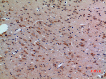 Arg Polyclonal Antibody