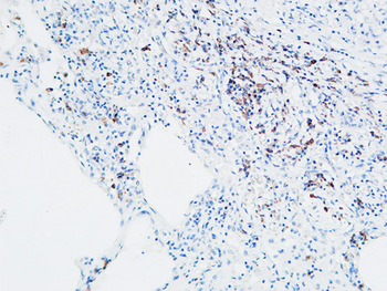 MPO Polyclonal Antibody