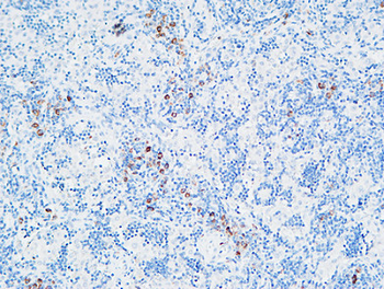 MPO Polyclonal Antibody