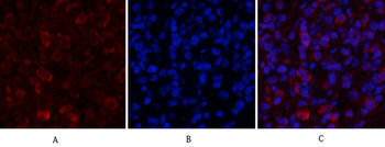 Nrf2 Polyclonal Antibody