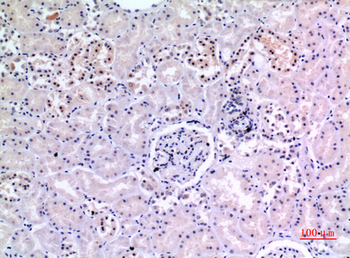 Ku-70 Polyclonal Antibody