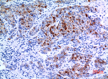 Keratin-pan Polyclonal Antibody