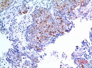 Keratin-pan Polyclonal Antibody