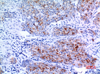 Keratin-pan Polyclonal Antibody