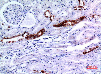 Cytokeratin 8 Polyclonal Antibody