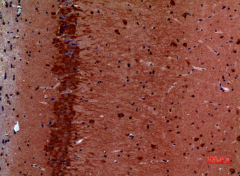 HSP 90 Polyclonal Antibody