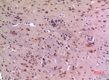 GDI-2 Polyclonal Antibody