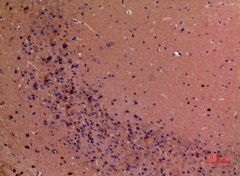 GDI-2 Polyclonal Antibody