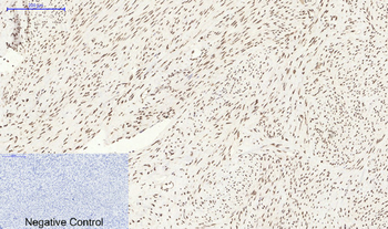 Bcl-6 Polyclonal Antibody