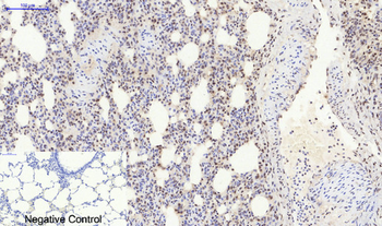 Bcl-6 Polyclonal Antibody
