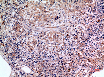 SCCA1/2 Polyclonal Antibody