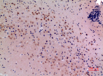 ARP Polyclonal Antibody