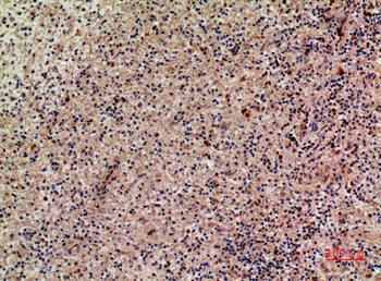 Lymphotactin Polyclonal Antibody