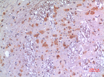 BMP-8A Polyclonal Antibody