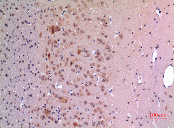 GDF-5 Polyclonal Antibody