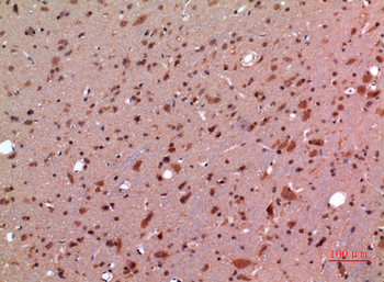GDF-5 Polyclonal Antibody