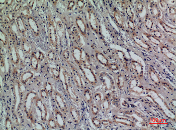 CD159a/c Polyclonal Antibody