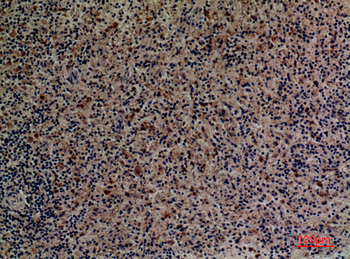 CD201 Polyclonal Antibody
