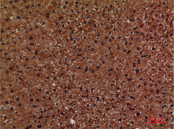 CD276 Polyclonal Antibody