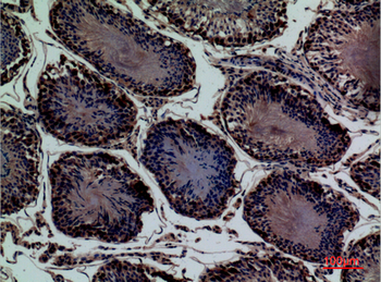 CD203c Polyclonal Antibody