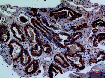 CD229 Polyclonal Antibody