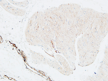CD59 Polyclonal Antibody