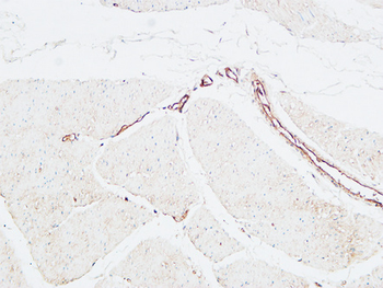 CD59 Polyclonal Antibody