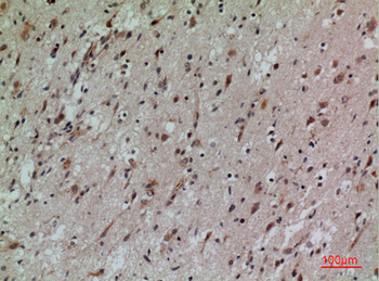 CD58 Polyclonal Antibody