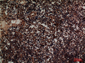 CD1D Polyclonal Antibody