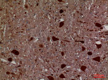 HEXA Polyclonal Antibody