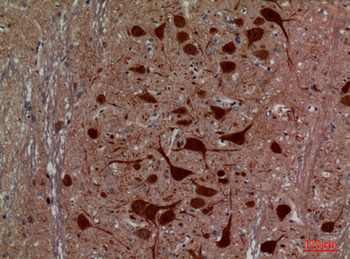HEXA Polyclonal Antibody
