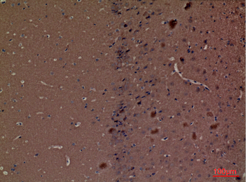 HEXA Polyclonal Antibody