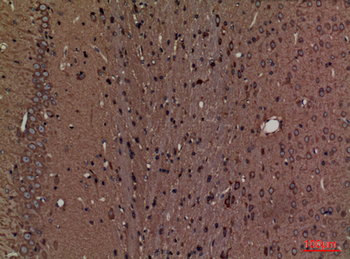 SPTLC1 Polyclonal Antibody