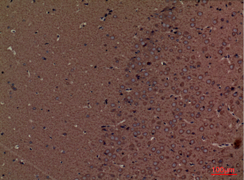 SPTLC1 Polyclonal Antibody