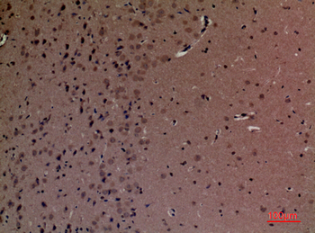 SHIP-2 Polyclonal Antibody