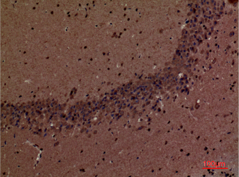 SHIP-2 Polyclonal Antibody