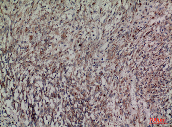 HDC Polyclonal Antibody