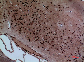 Layilin Polyclonal Antibody