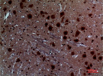 Layilin Polyclonal Antibody