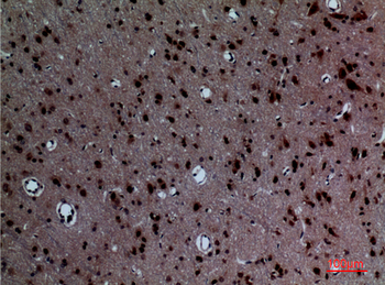 Layilin Polyclonal Antibody
