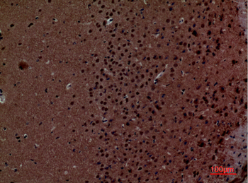 Layilin Polyclonal Antibody