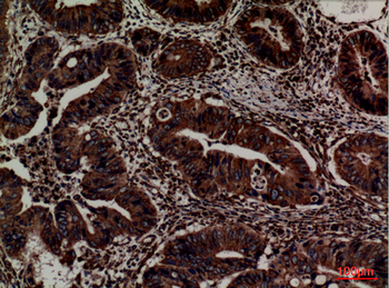 ERp57 Polyclonal Antibody