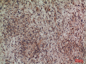 Lipocalin-1 Polyclonal Antibody