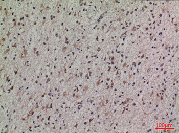 Lipocalin-1 Polyclonal Antibody