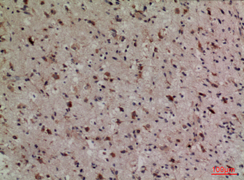 Lipocalin-1 Polyclonal Antibody