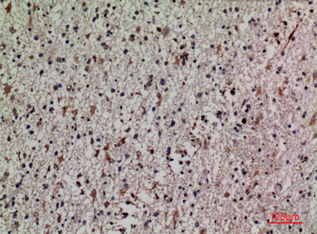 Keap1 Polyclonal Antibody