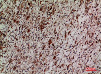 Keap1 Polyclonal Antibody