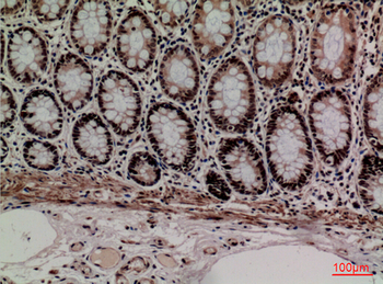 MCM3 Polyclonal Antibody