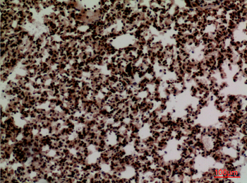 FOXP1 Polyclonal Antibody