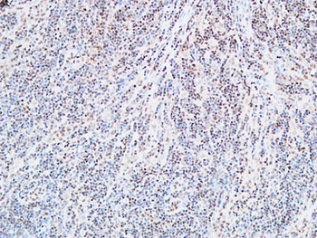 FOXP1 Polyclonal Antibody
